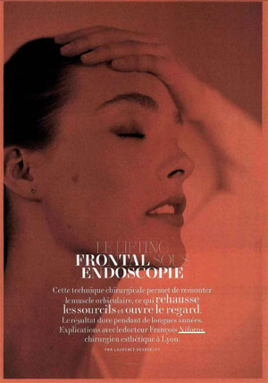 L'Officiel Chirurgie Esthétique : le lifting frontal sous endoscopie