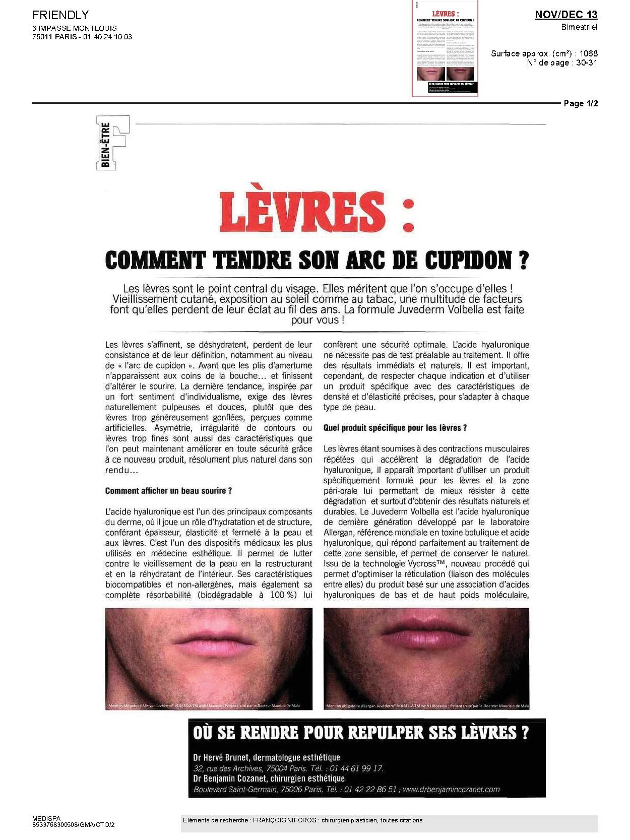 Lèvres : comment tendre son arc de cupidon ? FRIENDLY