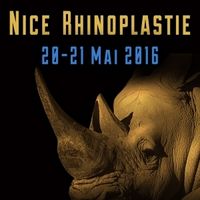 Nice rhinoplastie