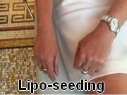 Émission TV : Lipo-seeding