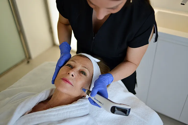 Microneedling Dermapen au Medispa de Lyon