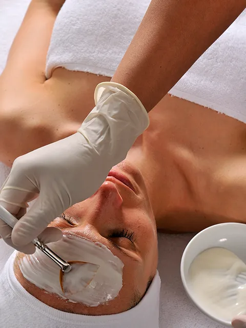 Application d'un peeling du visage au Medispa de Lyon