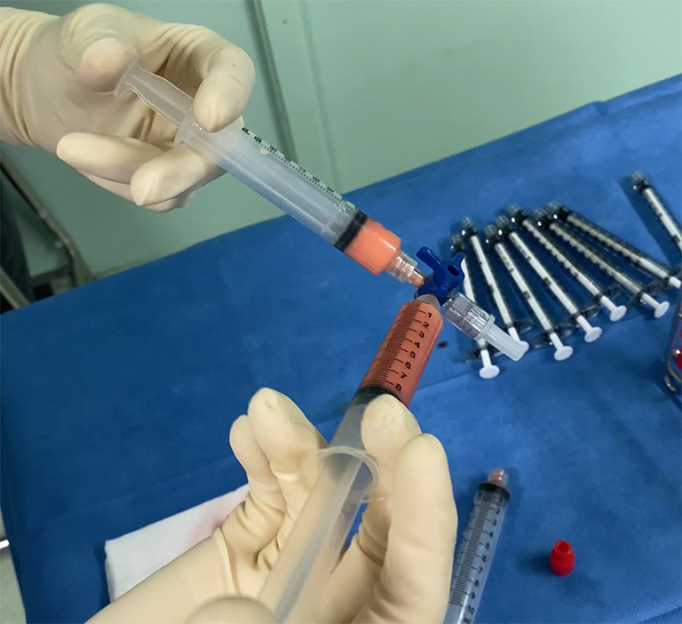 Purification des graisses triées