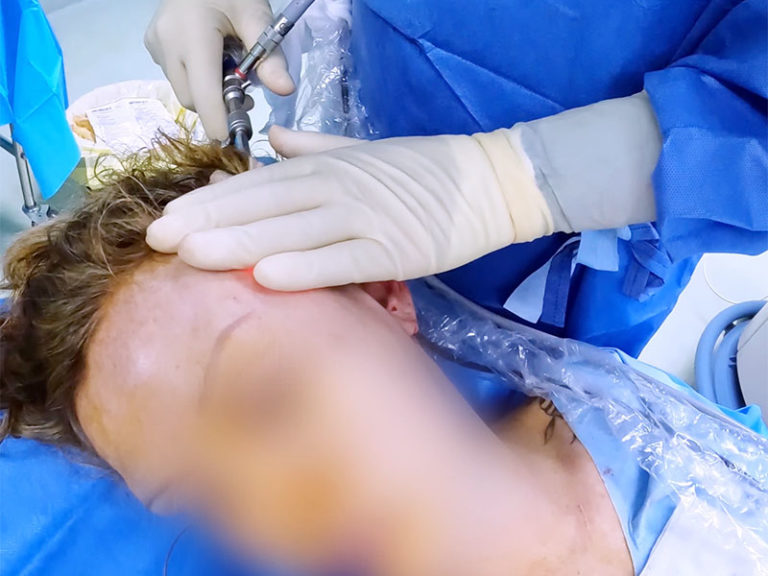 Lifting complet du visage au bloc opératoire de la Clinique Niforos de Lyon